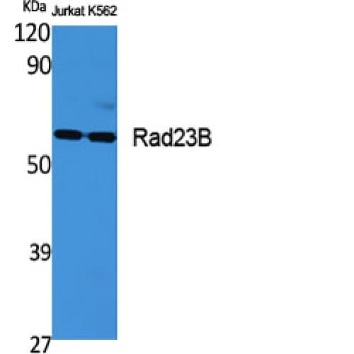 RAD23B / HR23B Antibody (10-90 aa, N-terminal)