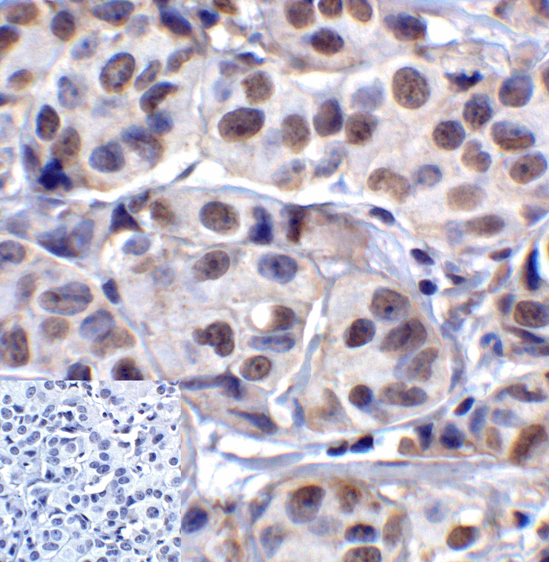 Monoclonal Mouse anti-Human LAG3 Antibody (clone 2G8, IHC, IF, WB)