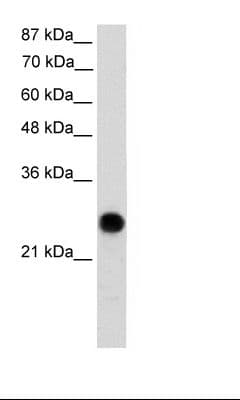 VDAC2 Antibody (N-Terminus)
