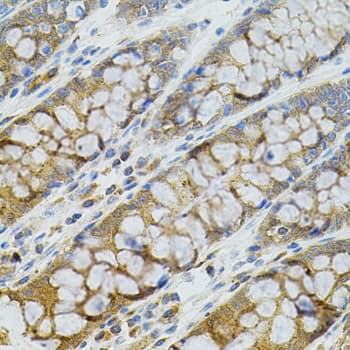 BCL2 / Bcl-2 Antibody