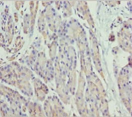 SCYL1 / NTKL Antibody