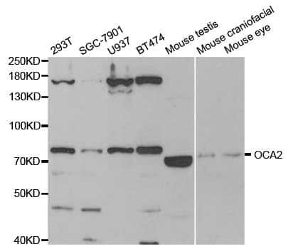 OCA2 / P protein Antibody