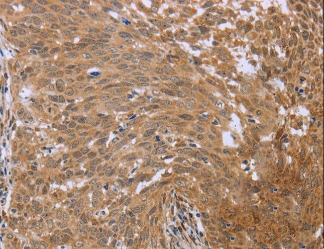 Polyclonal Rabbit anti-Human FHL2 Antibody (IHC, WB)