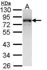 NDUFS1 Antibody (aa432-664)