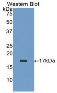 Polyclonal Rabbit anti-Human INHA / Inhibin Alpha Antibody (Biotin, aa233-366, WB)