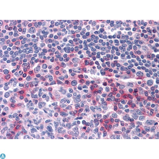 Monoclonal Mouse anti-Human CD69 Antibody (IHC, WB)