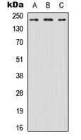 IHC-plus™ SCN8A / Nav1.6 Antibody (N-Terminus)