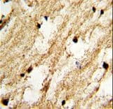 Polyclonal Rabbit anti-Human DCC1 / DSCC1 Antibody (aa61-87, IHC, WB)