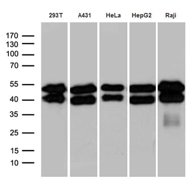 Monoclonal Mouse anti-Human GABPB1 Antibody (clone OTI4D5, aa128-360, WB)