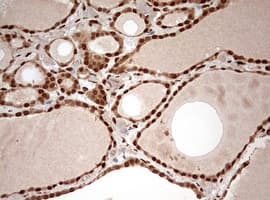 DOT1L / DOT1 Antibody (aa1008-1424, clone OTI6E7)