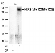 ERBB2 / HER2 Antibody
