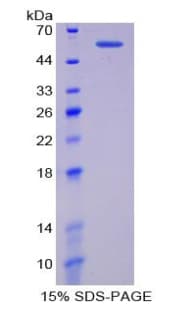 Mouse SERPINA7 / TBG Protein (Recombinant His-GST)
