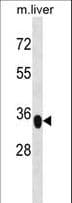 YIPF3 Antibody (aa292-321)