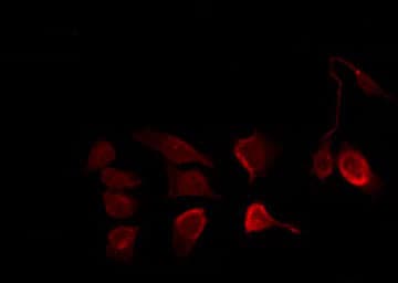IKBKB / IKK2 / IKK Beta Antibody (phospho-Tyr199)