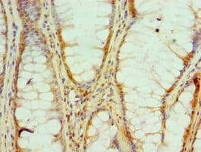 HNRPM / HNRNPM Antibody (aa491-730)