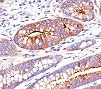 CEA / Carcinoembryonic Antigen Antibody (clone SPM551)