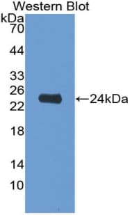 IL6 / Interleukin 6 Antibody (aa25-211, APC)