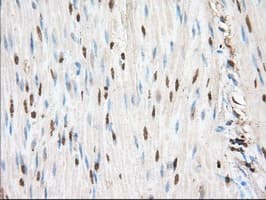 PIM2 / Pim-2 Antibody (clone OTI9A5)