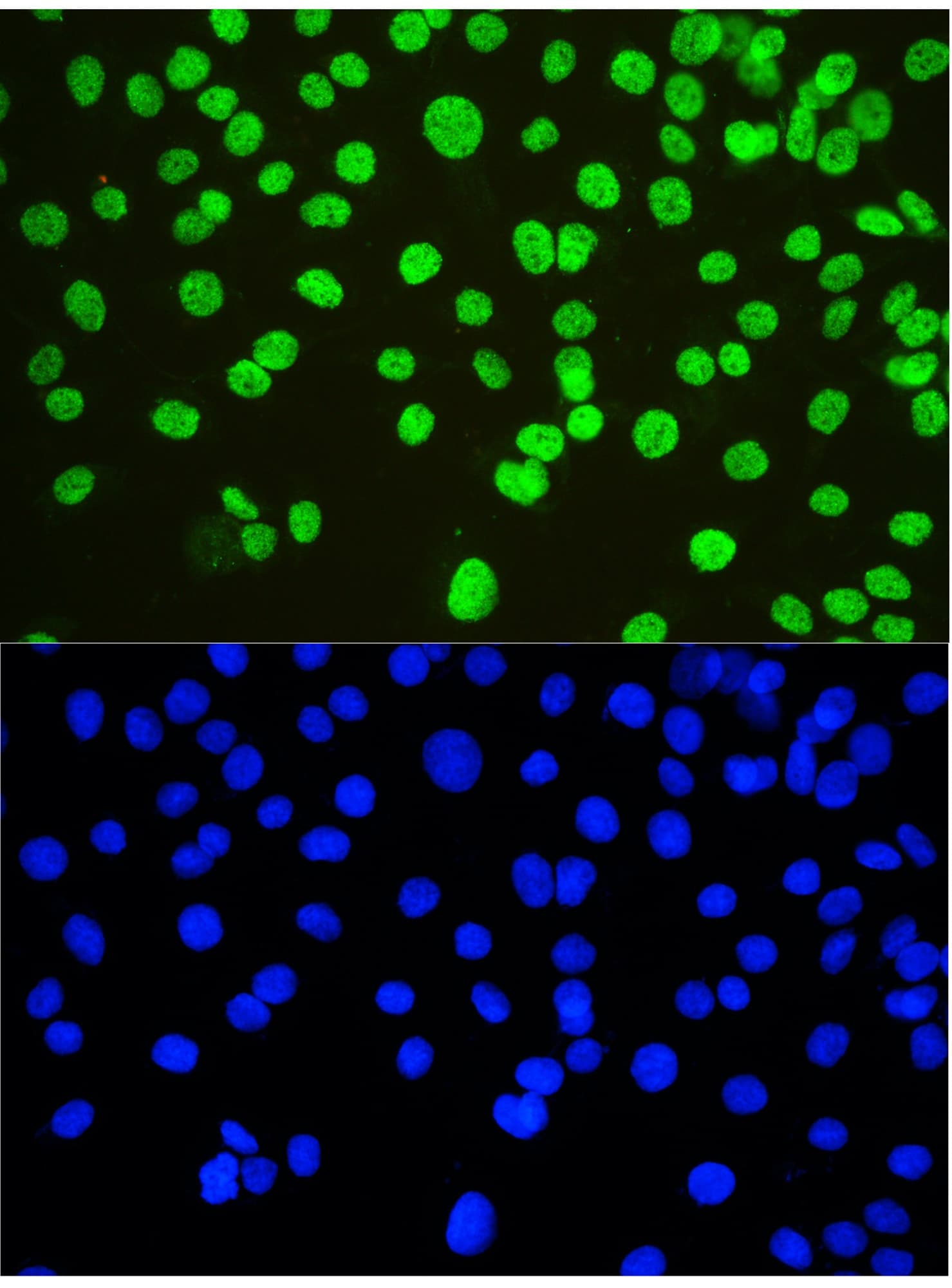NONO / P54NRB Antibody (aa1-35)