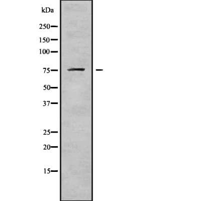 Polyclonal Rabbit anti-Human DDX18 Antibody (IF, WB)