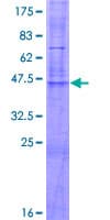 Human CLDN17 / Claudin 17 Protein (Recombinant GST)