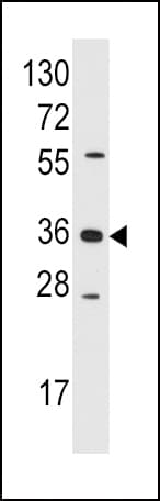 Polyclonal Rabbit anti-Human AKR1B1 / Aldose Reductase Antibody (aa102-135, IHC, IF, WB)