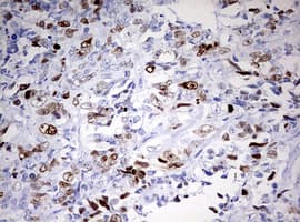 TOP2A / Topoisomerase II Alpha Antibody (aa1100-1531, clone OTI1D5)
