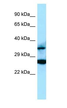 RASSF2 Antibody (C-Terminus)
