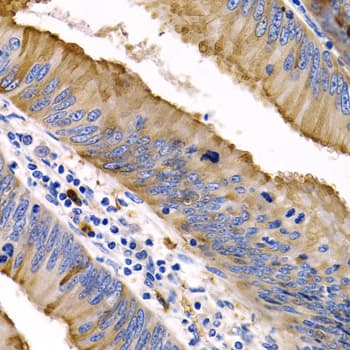 IL9 Antibody