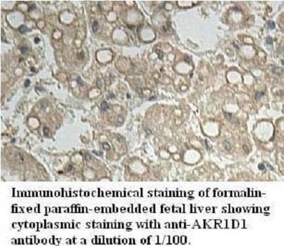 Polyclonal Rabbit anti-Human AKR1D1 Antibody (aa73-315, IHC, WB)