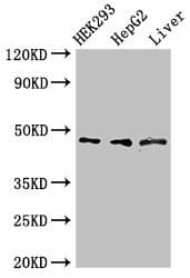 Polyclonal Rabbit anti-Human ACADSB Antibody (IHC, WB)