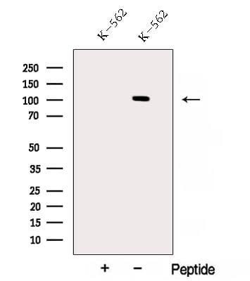 Polyclonal Rabbit anti-Human AP2B1 Antibody (WB)
