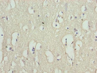 Polyclonal Rabbit anti-Human C8orf51 Antibody (IHC)