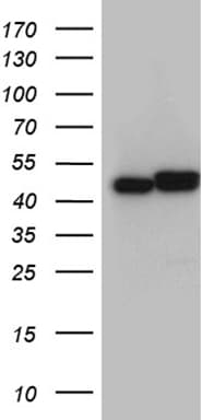 Monoclonal Mouse anti-Human HNRNPH1 / hnRNP H Antibody (clone OTI1H3, IHC, WB)