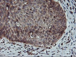 AGPAT5 Antibody (clone OTI1H10, Carrier-free)