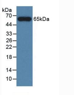 Human MYC / c-Myc Protein (Recombinant His-GST, N-terminus)