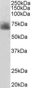 SLC6A4 / SERT Antibody (aa116-126)