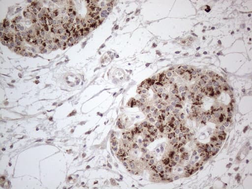 FOXO4 / AFX1 Antibody (aa206-505, clone OTI8A8)