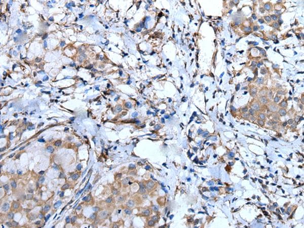 F3 / CD142 / Tissue factor Antibody