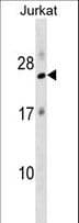 Polyclonal Rabbit anti-Human RPL18 / Ribosomal Protein L18 Antibody (aa1-30, WB)