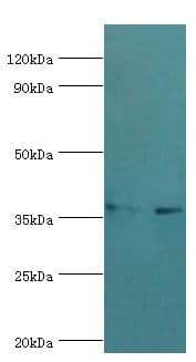 Polyclonal Rabbit anti-Human HNRNPD / AUF1 Antibody (aa1-306, IHC, WB)