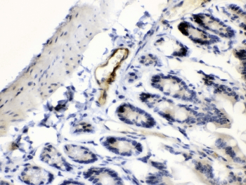 Polyclonal Rabbit anti-Human ANGPTL2 / ARP2 Antibody (IHC, WB)
