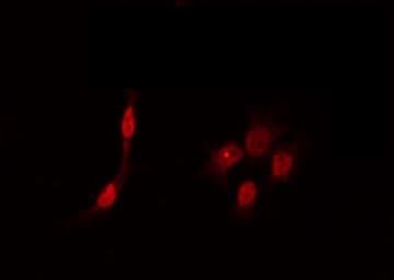 DYRK1B Antibody