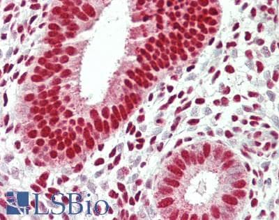 IHC-plus™ Polyclonal Rabbit anti-Human RBM25 / SNU71 Antibody (aa475-525, IHC, WB)