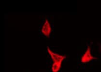 KDELR3 Antibody