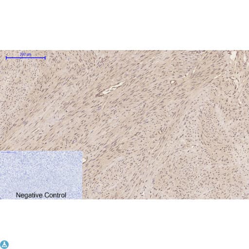 EP300 / p300 Antibody