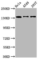 Polyclonal Rabbit anti-Human MAN2B2 Antibody (IHC)