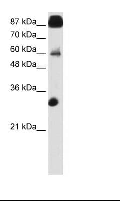 Polyclonal Rabbit anti-Human CTCF Antibody (N-Terminus, IHC, WB)