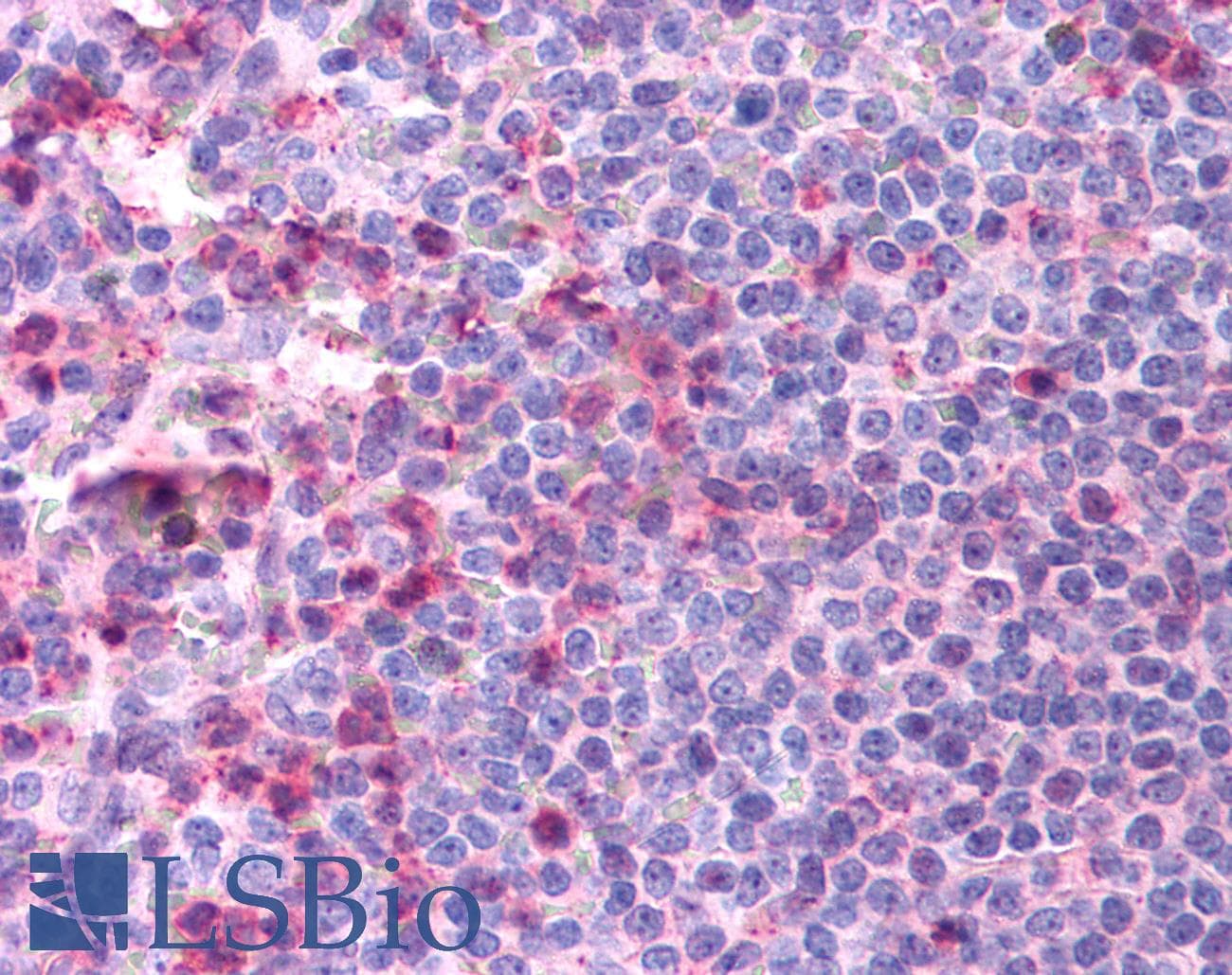 PathPlus™ CCR4 Antibody (C-Terminus)