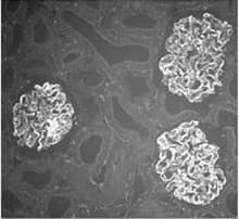 ACTN4 Antibody (aa27-38)